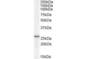 Image no. 2 for anti-Cysteine and Glycine-Rich Protein 2 (CSRP2) (Internal Region) antibody (ABIN374898) (CSRP2 Antikörper  (Internal Region))