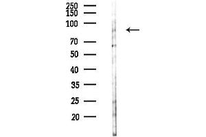 anti-L(3)mbt-Like 1 (L3MBTL1) (Internal Region) antibody