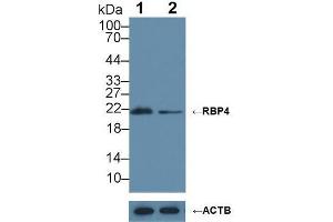 Western blot analysis of (1) Wild-type HepG2 cell lysate, and (2) RBP4 knockout HepG2 cell lysate, using Rabbit Anti-Cow RBP4 Antibody (1 µg/ml) and HRP-conjugated Goat Anti-Mouse antibody ( (RBP4 Antikörper  (AA 19-201))