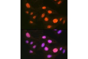 Immunofluorescence analysis of U-2 OS cells using UB Rabbit mAb (ABIN7271185) at dilution of 1:100 (40x lens). (UBA1 Antikörper)