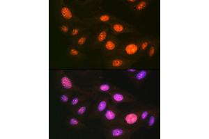 Immunofluorescence analysis of U-2 OS cells using UB Rabbit mAb (ABIN7271185) at dilution of 1:100 (40x lens).