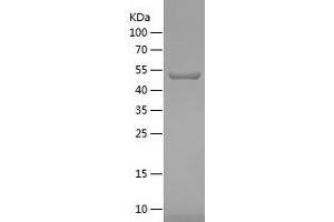 Western Blotting (WB) image for Heme Oxygenase (Decycling) 1 (HMOX1) (AA 1-267) protein (His-IF2DI Tag) (ABIN7123289) (HMOX1 Protein (AA 1-267) (His-IF2DI Tag))