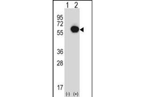 Western blot analysis of RANG (arrow) using rabbit polyclonal RANG Antibody (N-term) 3776a. (RANGAP1 Antikörper  (N-Term))