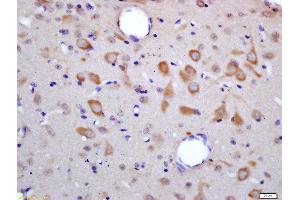 Formalin-fixed and paraffin embedded rat brain labeled with Rabbit Anti-HES6 Polyclonal Antibody, Unconjugated (ABIN1387271) at 1:200 followed by conjugation to the secondary antibody and DAB staining