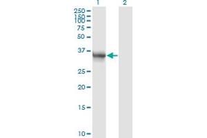 Western Blotting (WB) image for anti-Aldo-Keto Reductase Family 1, Member B10 (Aldose Reductase) (AKR1B10) (AA 76-143) antibody (ABIN566074)