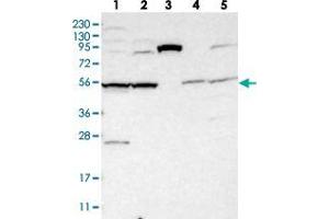 Western blot analysis of Lane 1: RT-4, Lane 2: U-251 MG, Lane 3: Human Plasma, Lane 4: Liver, Lane 5: Tonsil with SLC35F1 polyclonal antibody  at 1:250-1:500 dilution. (SLC35F1 Antikörper)