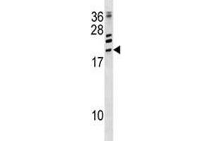 ATF3 antibody western blot analysis in CEM lysate.