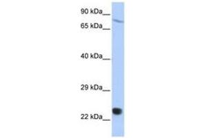 Image no. 1 for anti-SP110 Nuclear Body Protein (SP110) (AA 612-661) antibody (ABIN6742727) (SP110 Antikörper  (AA 612-661))