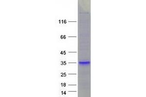 Western Blotting (WB) image for WAP Four-Disulfide Core Domain 1 (WFDC1) protein (Myc-DYKDDDDK Tag) (ABIN2735549)