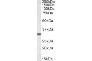 Image no. 1 for anti-Four and A Half LIM Domains 3 (FHL3) (C-Term) antibody (ABIN375133) (FHL3 Antikörper  (C-Term))