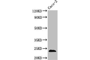 Western Blot Positive WB detected in: Caco-2 whole cell lysate All lanes: CLDN3 antibody at 3. (Claudin 3 Antikörper  (AA 181-220))