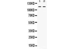 Western blot analysis of Argonaute 4 expression in rat thymus extract ( Lane 1) and 22RV1 whole cell lysates ( Lane 2). (AGO4 Antikörper  (N-Term))
