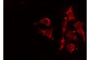 ABIN6276478 staining Hela cells by IF/ICC. (ACTR3 Antikörper  (C-Term))