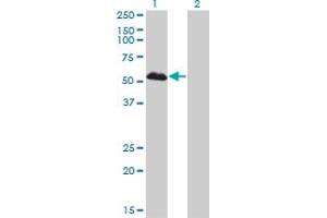 Western Blot analysis of FOXA1 expression in transfected 293T cell line by FOXA1 monoclonal antibody (M01), clone 2D7.