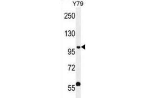 Western Blotting (WB) image for anti-PHD Finger Protein 20 (PHF20) antibody (ABIN2996558) (PHF20 Antikörper)