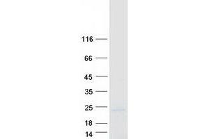 Western Blotting (WB) image for Complexin 2 (CPLX2) (Transcript Variant 1) protein (Myc-DYKDDDDK Tag) (ABIN2712470)