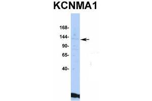 Host:  Rabbit  Target Name:  KCNMA1  Sample Type:  HepG2  Antibody Dilution:  1.