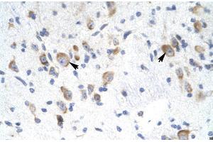 Human Brain; Rabbit Anti-GTF2F2 Antibody. (GTF2F2 Antikörper  (Middle Region))