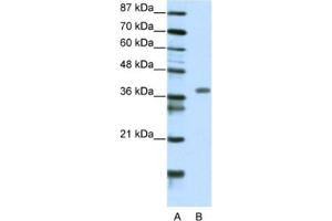Western Blotting (WB) image for anti-Mesenchyme Homeobox 2 (MEOX2) antibody (ABIN2460538) (MEOX2 Antikörper)