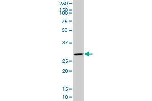 CDK4 monoclonal antibody (M09), clone 8A10. (CDK4 Antikörper  (AA 211-303))