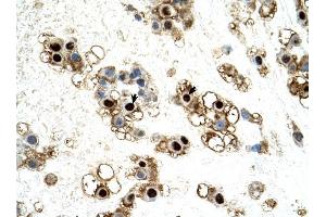 UNCX antibody was used for immunohistochemistry at a concentration of 4-8 ug/ml to stain Trophoblast cells (arrows) in Human Placenta.
