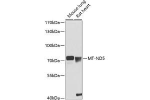 Western blot analysis of extracts of various cell lines, using MT-ND5 antibody (ABIN6135115, ABIN6144434, ABIN6144436 and ABIN6216103) at 1:1000 dilution. (MT-ND5 Antikörper  (AA 300-400))