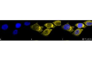 Immunocytochemistry/Immunofluorescence analysis using Rabbit Anti-SOD (Mn) Polyclonal Antibody . (SOD2 Antikörper  (Biotin))