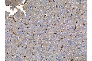ABIN6257649 and ABIN6275602 at 1/100 staining rat brain tissue by IHC-P. (Sorting Nexin 4 Antikörper  (Internal Region))