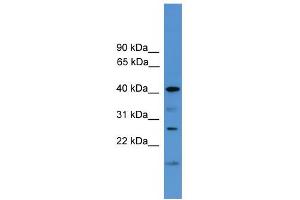 WB Suggested Anti-SCAMP1 Antibody Titration: 0. (SCAMP1 Antikörper  (Middle Region))