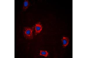 Immunofluorescent analysis of AKT staining in MCF7 cells. (AKT1 Antikörper  (Center))