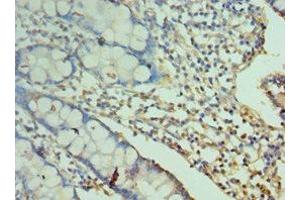 Immunohistochemistry of paraffin-embedded human small intestine tissue using ABIN7161084 at dilution of 1:100 (2B4 Antikörper  (AA 22-224))