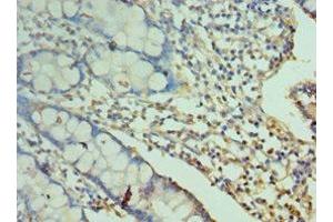 Immunohistochemistry of paraffin-embedded human small intestine tissue using ABIN7161084 at dilution of 1:100