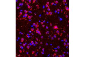 Immunofluorescence of paraffin embedded rat brain using deltex (ABIN7073794) at dilution of 1:200 (400x lens) (Deltex Homolog 1 Antikörper)