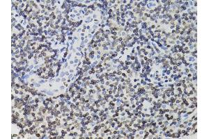 Immunohistochemistry of paraffin-embedded human tonsil using TMPO Antibody (ABIN1875122) at dilution of 1:100 (40x lens). (Thymopoietin Antikörper)