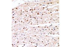 Immunohistochemical analysis of Cyclin E1 (pT77) staining in human heart formalin fixed paraffin embedded tissue section. (Cyclin E1 Antikörper  (pSer77))