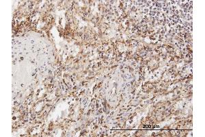 Immunoperoxidase of purified MaxPab antibody to TPP1 on formalin-fixed paraffin-embedded human spleen.