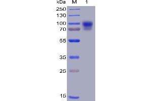 SDS-PAGE (SDS) image for Signal-Regulatory Protein alpha (SIRPA) (AA 31-373) protein (Fc-His Tag) (ABIN6961082)