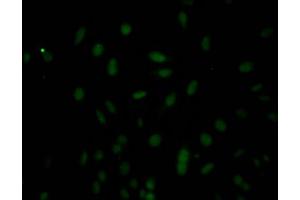Immunofluorescence staining of Hela Cells with ABIN7127776 at 1:50, counter-stained with DAPI. (Rekombinanter Caspase 3 Antikörper)