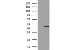 Western Blotting (WB) image for anti-Glyoxylate Reductase/hydroxypyruvate Reductase (GRHPR) antibody (ABIN1498517) (GRHPR Antikörper)