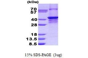 Image no. 1 for Poly (ADP-Ribose) Polymerase 2 (PARP2) protein (His tag) (ABIN1098789)