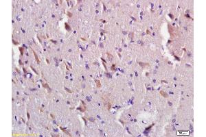 Formalin-fixed and paraffin embedded rat brain labeled with Anti-TMEM2L/KIAA1199 Polyclonal Antibody, Unconjugated (ABIN872432) at 1:200 followed by conjugation to the secondary antibody and DAB staining. (CEMIP Antikörper  (AA 101-200))