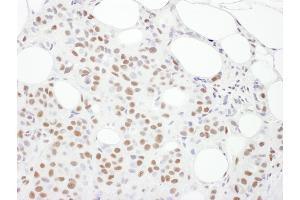 Immunohistochemistry (IHC) image for anti-Protein Kinase, DNA-Activated, Catalytic Polypeptide (PRKDC) (AA 4078-4128) antibody (ABIN7453431) (PRKDC Antikörper  (AA 4078-4128))