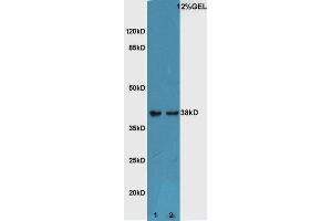 Lane 1:Mouse embryo lysate Lane 2:Mouse eye lysate probed with Rabbit Anti-ATF4/CREB-2 Polyclonal Antibody, Unconjugated  at 1:5000 for 90 min at 37˚C. (ATF4 Antikörper  (AA 251-351))