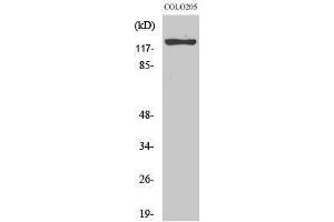Western Blotting (WB) image for anti-Suppression of Tumorigenicity 5 (ST5) (Internal Region) antibody (ABIN3177531) (ST5 Antikörper  (Internal Region))