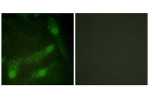 Immunofluorescence analysis of HeLa cells, using Smad2 (Phospho-Thr220) antibody.