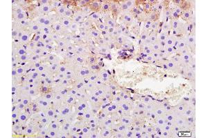 Formalin-fixed and paraffin embedded mouse liver labeled with Rabbit Anti SYVN1/HRD1 Polyclonal Antibody, Unconjugated (ABIN671811) at 1:200 followed by conjugation to the secondary antibody and DAB staining (SYVN1 Antikörper  (AA 531-617))