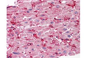 Anti-SCO1 antibody IHC of human heart. (SCO1 Antikörper  (Internal Region))