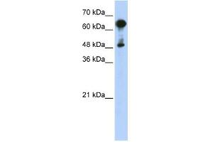 WB Suggested Anti-HSPA6 Antibody Titration: 0. (HSPA6 Antikörper  (Middle Region))