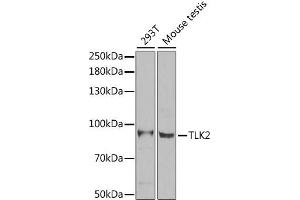 Western blot analysis of extracts of various cell lines, using TLK2 antibody. (TLK2 Antikörper)