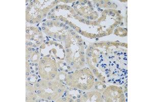 Immunohistochemistry of paraffin-embedded mouse kidney using CHMP1B antibody. (CHMP1B Antikörper  (AA 1-199))